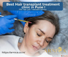 PRP Hair Restoration Treatment at Pune Skin Clinic