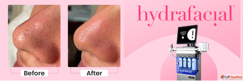 Best HydraFacial in Delhi - Dermapuritys