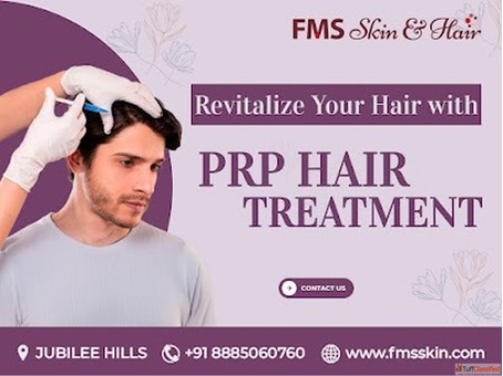 PRP Treatment Cost in Hyderabad