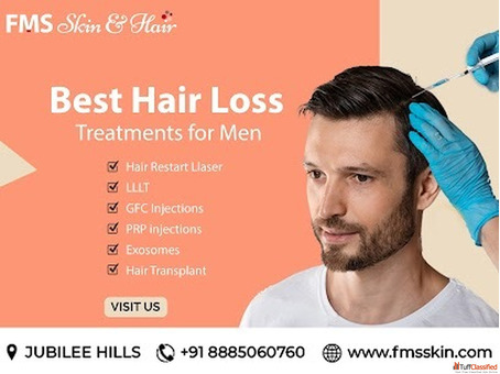 hair loss treatment in jubilee hills