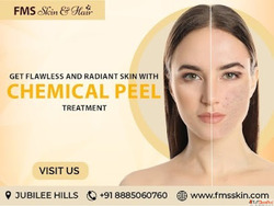 chemical peel treatment in Hyderabad