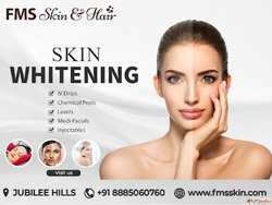 Skin whitening Treatment in Hyderabad
