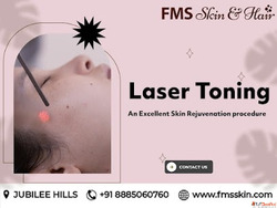 Laser Toning Treatment in Hyderabad