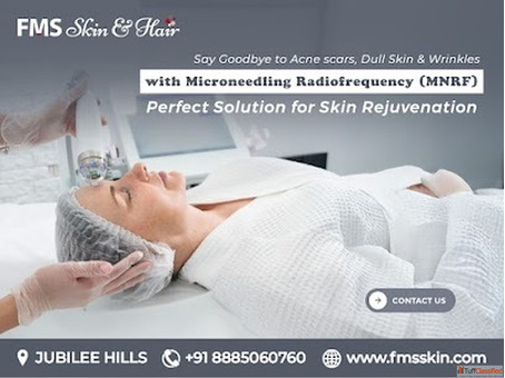 MNRF treatment in Hyderabad