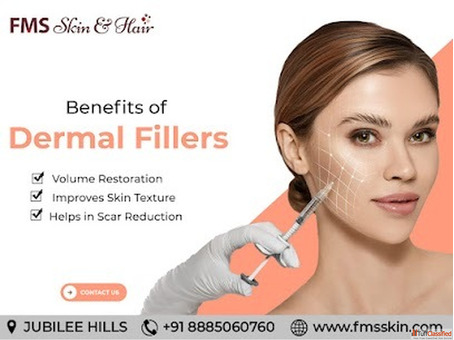 Dermal Fillers Treatments in Hyderabad