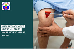 Looking For Knee Replacement Myths Facts
