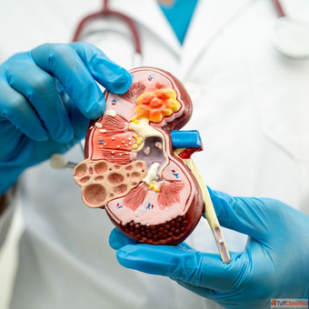 Expert Diabetic Kidney Disease Treatment in Mumbai by Senior Nephrologist