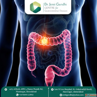 Advanced Colon Cancer Treatment Ahmedabad - Dr. Jenit Gandhi