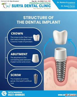 Best Tooth Cleaning in Lucknow Advanced Dental Scaling Polishing - Surya Dental Clinic
