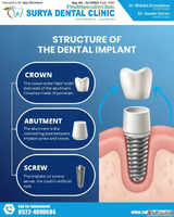 Best Tooth Cleaning in Lucknow Advanced Dental Scaling Polis...