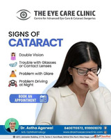 Cataract Surgery Cost in Lucknow Dr. Astha Agarwal - The Eye...