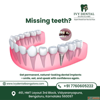 Missing Teeth Get Permanent Dental Implants in Bangalore