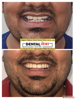Best Dentist in Mahindra SEZ Teeth Braces Mahindra SEZ Specialist