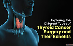 Best Thyroid Cancer Treatment in Delhi
