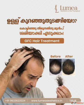 Premium Hair Transplant Clinic in Kerala Lumea Aesthetics