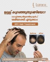 Premium Hair Transplant Clinic in Kerala Lumea Aesthetics
