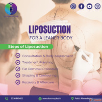 Best Liposuction Surgery in Ahmedabad at KosmoPlus