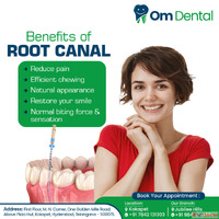 Smile correction in kokapet-Om Dental