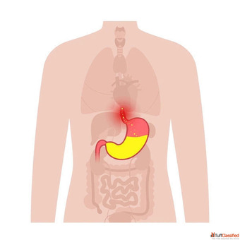 Minimally Invasive Surgery in Ahmedabad - Experienced Surgeon Dr. Vishal Soni