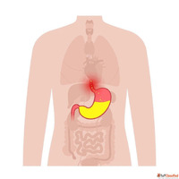 Minimally Invasive Surgery in Ahmedabad - Experienced Surgeo...