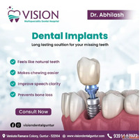 Dental Implants in Guntur - Permanent Solution for Missing T...