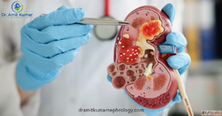 Best Nephrologist in Delhi NCR
