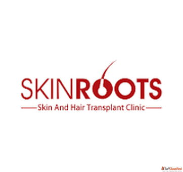 Best hair transplant clinic in delhi
