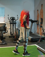 Bone Lengthening Surgery in India - Procedure Benefits Recov...