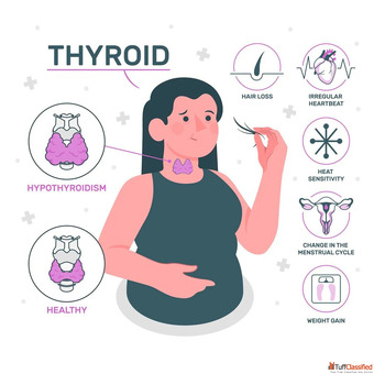 Hidden Dangers of High TSH Levels and How to Manage Them