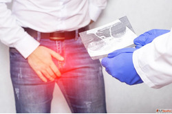 Consult an Experienced Varicocele Specialist for Advanced Pe...