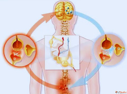 Neuropathic Pain Treatment in Ahmedabad Impulse Pain Clinic