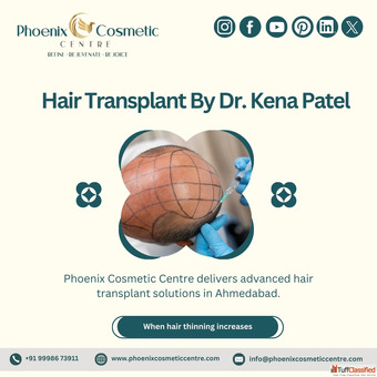 Hair Transplant Specialists in Ahmedabad - Phoenix Cosmetic
