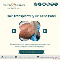 Hair Transplant Specialists in Ahmedabad - Phoenix Cosmetic