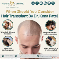 Phoenix Cosmetic - Safe Hair Transplant in Ahmedabad