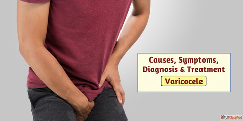 Varicocele Surgery Cost Affordable Treatment Options Pricing Details