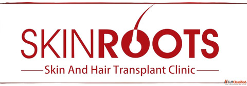 Best Clinic for hair Transplant