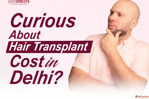 Hair Transplant Cost in Delhi