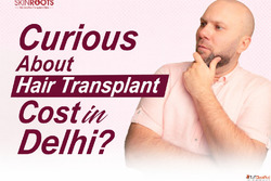 Hair Transplant Cost in Delhi