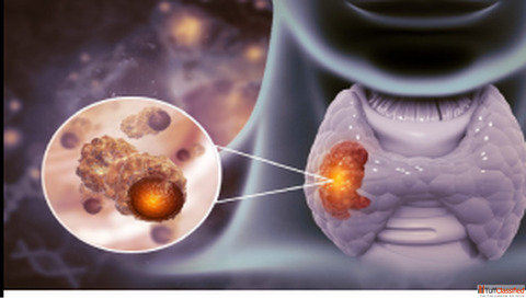 Thyrafemme Balance - New Japanese-Inspired Thyroid Supplements - health