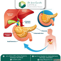Best Pancreas Surgeon in Ahmedabad India for Minimally Invas...