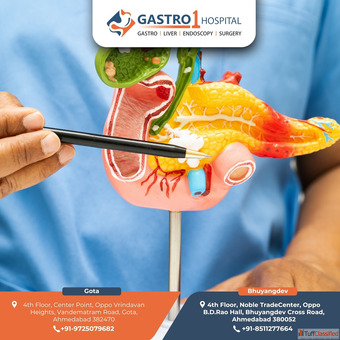 Safe and Effective Gallbladder Stone Treatment in Ahmedabad