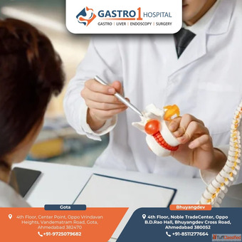 Gastro1 Hospital - Reliable Hernia Doctor in Ahmedabad for Complete Care
