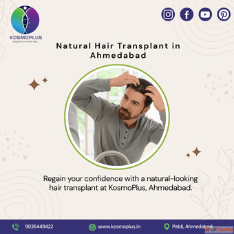 KosmoPlus - Advanced Hair Transplant in Ahmedabad for Permanent Results