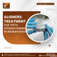 Aligners Treatment for Teeth Straightening in Indirapuram