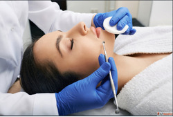 Best Chemical Peel For Hyperpigmentation in Faridabad