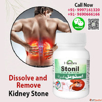Kidney stone treatment without surgery