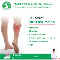 Best Hospital for Varicose Vein Treatment in India - Advance...