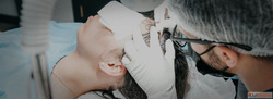 Safe Natural and Permanent Female Hair Transplant
