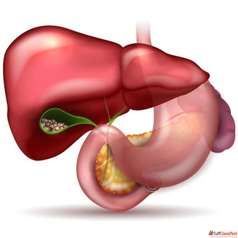 Best Pancreatic Surgeon in Ahmedabad - Trusted Surgical Gastroenterology Care