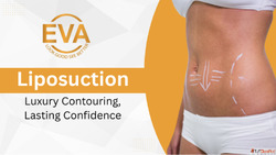 Top Benefits of Liposuction in Delhi - Liposuction Surgery B...